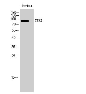 TPX2 Polyclonal Antibody