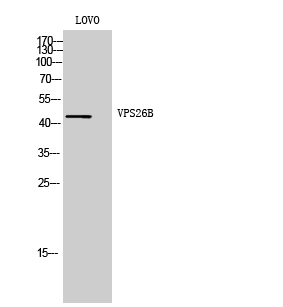 VPS26B Polyclonal Antibody