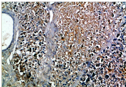 Insulin Polyclonal Antibody