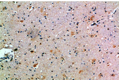 CCL14 Polyclonal Antibody