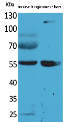 ALDH1A1 Polyclonal Antibody