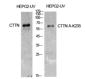 Cortactin Polyclonal Antibody