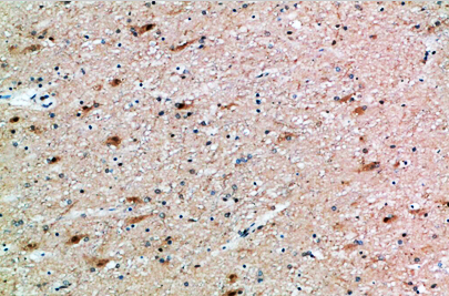 FSHβ Polyclonal Antibody