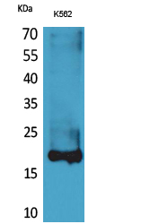 Lipocalin-1 Polyclonal Antibody