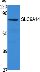 SLC6A14 Polyclonal Antibody