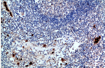 ZAP-70 Polyclonal Antibody