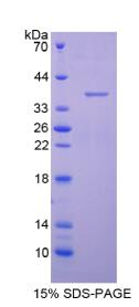 Recombinant Aquaporin 1, Colton Blood Group (AQP1)