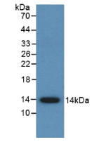 Monoclonal Antibody to Anti Mullerian Hormone (AMH)