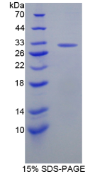 Recombinant Caspase 10 (CASP10)