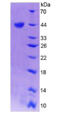 Recombinant Three Prime Repair Exonuclease 1 (TREX1)