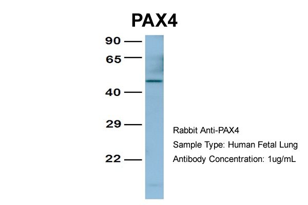 PAX4 antibody - middle region