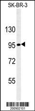 Nephrin Antibody (Ascites)