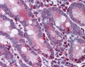 Caspase-3 Antibody