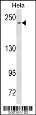 NOTCH3 Antibody (C-term Q2306)