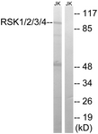 RSK1/2/3/4 antibody