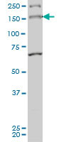 MYO3A Antibody (monoclonal) (M01)