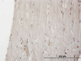 MEF2B Antibody (monoclonal) (M06)