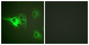 Keratin 8 (Phospho-Ser432) antibody