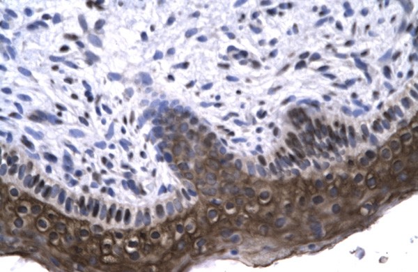 RAX antibody - N-terminal region