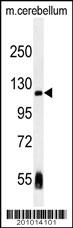 NLRP12 antibody (Ascites)