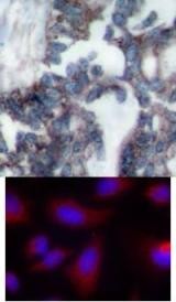 p70 S6 Kinase Antibody