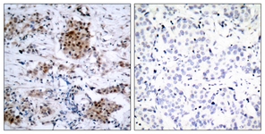 Estrogen Receptor-alpha (Phospho-Ser167) antibody