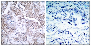p53 (Phospho-Ser15) antibody