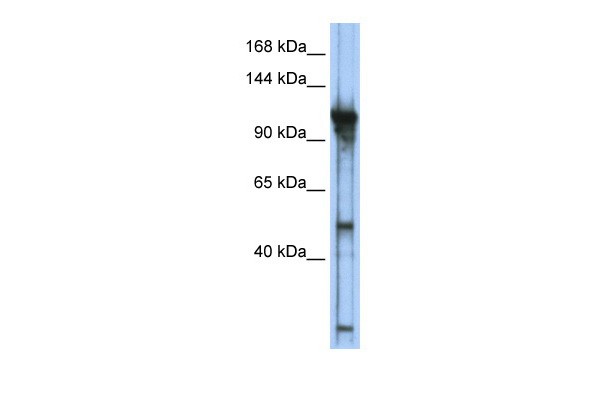 GTF3C2 antibody - middle region