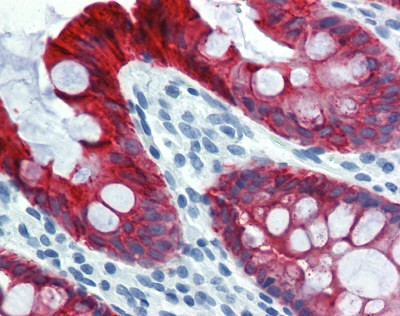 Cytoke Antibody