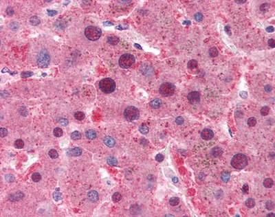 MYC Antibody