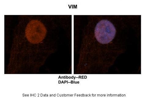 VIM antibody - N-terminal region