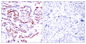 ATF2 (Phospho-Ser112 or 94)antibody