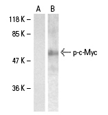 p-c-Myc Antibody (Thr 358)