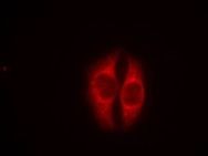 p53 (phospho Ser37) Antibody