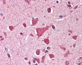 TP53 Antibody, Monoclonal