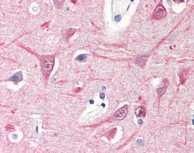 14-3-3 Beta Antibody