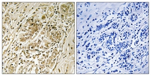 IRS-1 (Phospho-Ser639) antibody