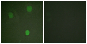 MYC antibody
