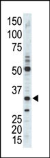 CDC2 Antibody