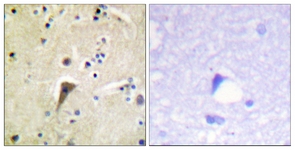 FAK (Phospho-Tyr397) antibody