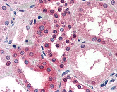 SMAD3 Antibody