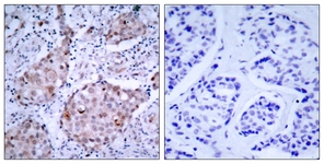 HER2 (Phospho-Tyr1221/Tyr1222) antibody