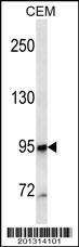 MME/CD10 Antibody (ascites)