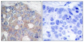 p70 S6 Kinase antibody