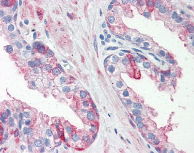 HSPB1 Antibody