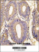 PAK1 Antibody