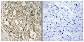 NF-kappaB p65 (Phospho-Ser529) antibody