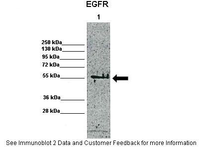 EGFR antibody - middle region