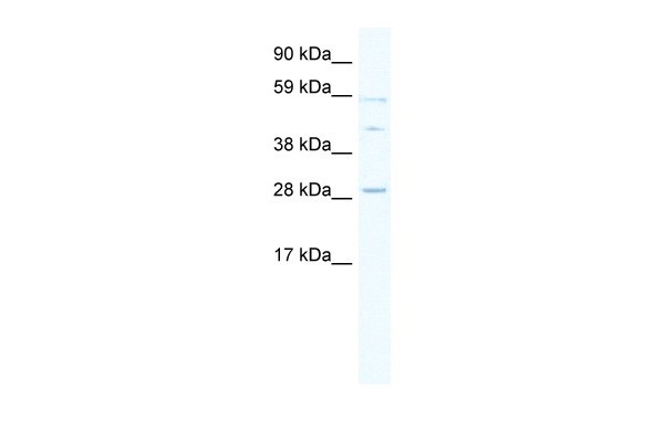 SPI1 antibody
