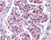 PTK2B Antibody